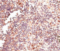 IHC testing of FFPE human lymph node tissue with GLI2 antibody at 4ug/ml. HIER: steam section in pH6 citrate buffer for 20 min.