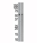 Reptin antibody used in western blot to detect RUVBL2 in mouse kidney (left) and human SK-BR-3 (right) lysate. Expected molecular weight: 48-51 kDa.
