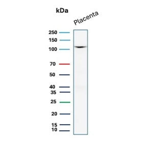 Western blot testing of human placental tissue lysate with recombinant CDH1 antibody. Expected molecular weight: 135 kDa (precursor), 80-120 kDa (mature, depending on glycosylation level).