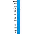Western blot testing of human Raji cell lysate with recombinant CD10 antibody at 1:1:000. Routinely visualized at ~100 kDa.
