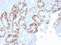 IHC staining of FFPE human kidney with RBP4 antibody. HIER: boil tissue sections in pH 9 10mM Tris with 1mM EDTA for 20 min and allow to cool before testing.