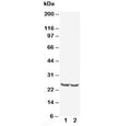 Western blot testing of TIMP4 antibody and Lane 1: rat kidney; 2: human MCF-7; Predicted/observed molecular weight: ~25 kDa.