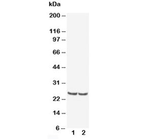 Western blot testing of TIMP4 antibody and Lane 1: rat kidney; 2: human MCF-7; Predicted/observed molecular weight: ~25 kDa.
