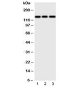 Western blot testing of ERBB4 antibody and Lane 1: human HeLa; 2: (h) U87; 3: mouse Neuro-2a cell lysate. Predicted molecular weight: 147-180kDa (precursor), 120, 80 kDa (cleaved forms). Observed here at ~147kDa.