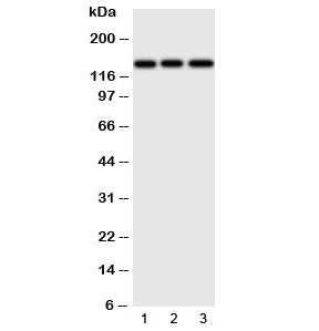 Western blot testing of ERBB4 antibody and Lane 1: human HeLa; 2: (h) U87; 3: mouse Neuro-2a cell lysate. Predicted molecular weight: 147-180kDa (precursor), 120, 80 kDa (cleaved forms). Observed here at ~147kDa.