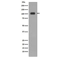 Western blot testing of human HeLa lysate with KDM1 / LSD1 antibody. Predicted molecular weight ~110 kDa.