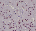 IHC staining of FFPE mouse brain with CREB1 antibody. HIER: boil tissue sections in pH6, 10mM citrate buffer, for 10-20 min and allow to cool before testing.