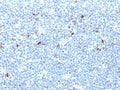 IHC: Formalin-fixed, paraffin-embedded human tonsil stained with HLA-Aw32 / HLA-A25 antibody (CATA-1).