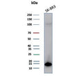 Western blot testing of human SK-BR-3 cell lysate with S100P antibody (clone S100P/7373). Predicted molecular weight ~10 kDa.