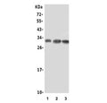 Western blot testing of human 1) U-87 MG, 2) 22RV1 and 3) A549 lysate with Beta NGF antibody. Predicted molecular weight ~27 kDa (dimer).