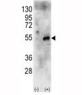 Western blot analysis of p70S6Kb antibody and 293 cell lysate (2 ug/lane) either nontransfected (Lane 1) or transiently transfected with the human RPS6KB2 gene (2). Predicted molecular weight: 60-70 kDa