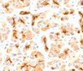 IHC testing of FFPE human pancreas with recombinant CFTR antibody (clone CFTR1-2R). HIER: boil tissue sections in 10mM Tris with 1mM EDTA, pH9 for 10-20 min followed by cooling at RT for 20 min.