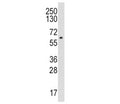 Western blot analysis of CYP19A1 / Aromatase antibody and HL-60 lysate. Predicted molecular weight ~58 kDa.