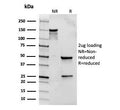 SDS-PAGE analysis of purified, BSA-free recombinant TLR2 antibody (clone rTLR2/221) as confirmation of integrity and purity.