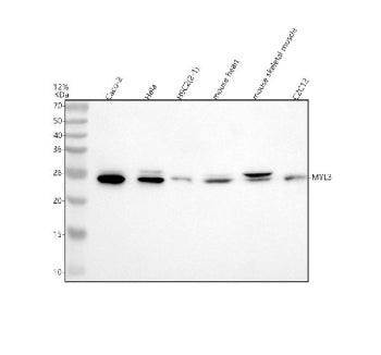 Western blot analysis of MYL3 using anti-MYL3 antibody. Lane 1: human Caco-2 whole cell lysates, Lane 2: human Hela whole cell lysates, Lane 3: human H9C2(2-1) whole cell lysates, Lane 4: mouse heart tissue lysates, Lane 5: mouse skeletal muscle tissue lysates, Lane 6: mouse C2C12 whole cell lysates. After electrophoresis, proteins were transferred to a nitrocellulose membrane at 150 mA for 50-90 min. Blocked the membrane with 5% non-fat milk/TBS for 1.5 hour at RT.