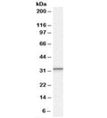 Western blot testing of human peripheral blood mononucleocyte lysate with PSME1 antibody at 0.3ug/ml. Predicted molecular weight: ~29kDa.