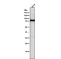 All lanes use the PKC antibody at 1:5K dilution for 1 hour at room temperature.