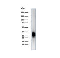 Western blot testing of human testis tissue lysate using Calbindin 2 antibody (clone CALB2/7029R). Predicted molecular weight ~29 kDa.
