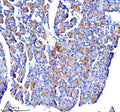 Immunohistochemical staining of CTRC using anti-CTRC antibody. CTRC was detected in a paraffin-embedded section of human pancreas tissue. Heat mediated antigen retrieval was performed in EDTA buffer (pH 8.0, epitope retrieval solution). The tissue section was blocked with 10% goat serum. The tissue section was then incubated with 2 ug/ml rabbit anti-CTRC antibody overnight at 4oC. Peroxidase Conjugated Goat Anti-rabbit IgG was used as secondary antibody and incubated for 30 min at 37oC.