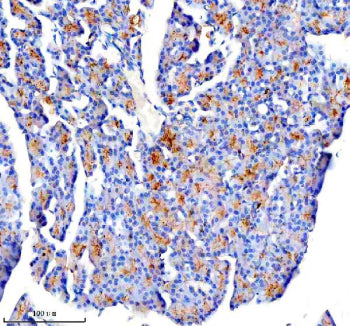 Immunohistochemical staining of CTRC using anti-CTRC antibody. CTRC was detected in a paraffin-embedded section of human pancreas tissue. Heat mediated antigen retrieval was performed in EDTA buffer (pH 8.0, epitope retrieval solution). The tissue section was blocked with 10% goat serum. The tissue section was then incubated with 2 ug/ml rabbit anti-CTRC antibody overnight at 4oC. Peroxidase Conjugated Goat Anti-rabbit IgG was used as secondary antibody and incubated for 30 min at 37oC.