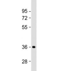 Western blot testing of human brain lysate with NMNAT1 antibody at 1:2000. Predicted molecular weight: 32 kDa.