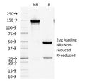 SDS-PAGE analysis of purified, BSA-free Factor XIIIa antibody (clone F13A1/1447) as confirmation of integrity and purity.