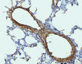 IHC staining of FFPE rat lung tissue with Collagen I antibody. HIER: boil tissue sections in pH8 EDTA for 20 min and allow to cool before testing.