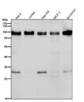 Western blot testing of human samples using the UBTF antibody at 1:1000 dilution for 1 hour at room temperature. A predominant band is detected at an approximately 89 kDa in all samples, consistent with full length UBTF. Lysates also show a weaker band near 30 kDa, which likely represents a proteolytic fragment of UBTF that retains the antibody epitope rather than a distinct isoform.