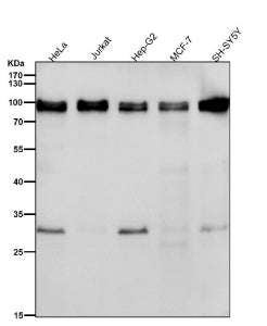 Western blot testing of human samples using the UBTF antibody at 1:1000 dilution for 1 hour at room temperature. A predominant band is detected at an approximately 89 kDa in all samples, consistent with full length UBTF. Lysates also show a weaker band near 30 kDa, which likely represents a proteolytic fragment of UBTF that retains the antibody epitope rather than a distinct isoform.