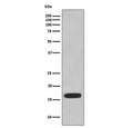 Western blot testing of HUVEC cell lysate with CD59 antibody. Expected molecular weight: 14-20 kDa depending on level of glycosylation.