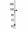Western blot analysis of CD11c antibody and MDA-MB231 lysate. Predicted molecular weight: 128~150 kDa.