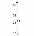 Western blot analysis of BDNF antibody and CEM lysate.
