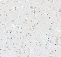 IHC staining of FFPE human brain tissue with iNOS antibody, HRP-secondary and DAB substrate. HIER: boil tissue sections in pH8 EDTA for 20 min and allow to cool before testing.