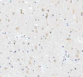 IHC staining of FFPE human brain tissue with iNOS antibody, HRP-secondary and DAB substrate. HIER: boil tissue sections in pH8 EDTA for 20 min and allow to cool before testing.