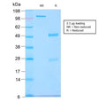 SDS-PAGE analysis of purified, BSA-free recombinant GNRHR / LHCGR antibody (clone GNRHR/2982R) as confirmation of integrity and purity.