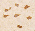 IHC testing of FFPE human brain tissue with PREX1 antibody. HIER: steam section in pH6 citrate buffer for 20 min and allow to cool prior to staining.