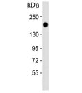 Western blot analysis of Epidermal growth factor receptor antibody and HeLa lysate. Expected molecular weight: ~134/170 kDa (unmodified/glycosylated).