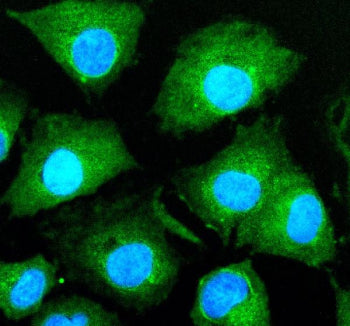 Immunofluorescent staining of HJURP using anti-HJURP antibody (green). HJURP was detected in an immunocytochemical section of cells. Enzyme antigen retrieval was performed using IHC enzyme antigen retrieval reagent for 15 mins. The cells were blocked with 10% goat serum. And then incubated with 5 ug/ml rabbit anti-HJURP antibody overnight at 4oC. DyLight 488 Conjugated Goat Anti-Rabbit IgG was used as secondary antibody at 1:500 dilution and incubated for 30 min at 37oC.