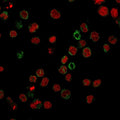 FUT4 Antibody U937 Immunofluorescence. Immunofluorescent analysis of human U937 cells stained with FUT4 Antibody demonstrates prominent membranous and cell surface-associated green fluorescence consistent with Fucosyltransferase 4-associated Lewis X/CD15 carbohydrate antigen biosynthesis pathways in myeloid-associated cellular populations.