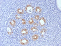 IHC staining of FFPE human cervix tissue with CDKN2A antibody (clone rCDKN2A/8004). HIER: boil tissue sections in pH 9 10mM Tris with 1mM EDTA for 20 min and allow to cool before testing.