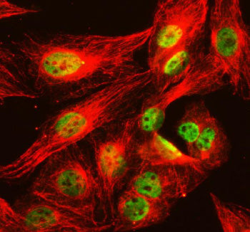 Immunofluorescent staining of NCOR2 using anti-NCOR2 antibody (green) and anti-Tubulin Alpha antibody (red). NCOR2 was detected in immunocytochemical section of U2OS cell. Enzyme antigen retrieval was performed using IHC enzyme antigen retrieval reagent for 15 mins. The cells were blocked with 10% goat serum. And then incubated with 5 ug/ml rabbit anti-NCOR2 antibody and mouse anti-Tubulin Alpha antibody overnight at 4oC.