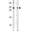 Western blot analysis of lysate from (1) mouse brain and (2) mouse skeletal muscle tissue lysate using Olig3 antibody at 1:1000.