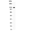 Western blot testing of C5 antibody and rat liver lysate; Predicted molecular weight: ~115 kDa (C5 alpha chain).