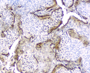 IHC testing of FFPE human tonsil tissue with Elafin antibody at 2ug/ml. HIER: boil tissue sections in pH6, 10mM citrate buffer, for 10-20 min followed by cooling at RT for 20 min.