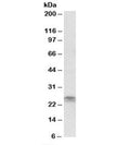 Western blot testing of Jurkat lysate with FGF8 antibody at 2ug/ml. Predicted molecular weight: ~25 kDa.