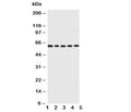 Western blot testing of Iduronate 2 sulfatase antibody and Lane 1: HeLa; 2: SMMC-7721; 3: A549; 4: MCF-7; 5: COLO cell lysate. Predicted size ~62KD