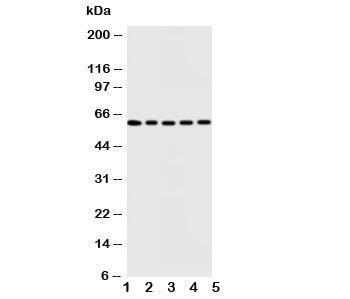 Western blot testing of Iduronate 2 sulfatase antibody and Lane 1: HeLa; 2: SMMC-7721; 3: A549; 4: MCF-7; 5: COLO cell lysate. Predicted size ~62KD