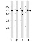 Western blot analysis of lysate from 1) human kidney, 2) mouse kidney, 3) mouse liver and 4) rat kidney tested with ACSM5 antibody at 1:1000. Predicted molecular weight ~65 kDa.
