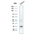 Western blot testing of human spleen tissue with Stathmin 1 antibody (clone STMN1/8437). Predicted molecular weight ~17 kDa.