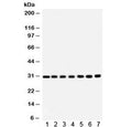 Western blot testing of 1) rat brain, 2) rat liver, 3) rat kidney, 4) mouse brain, 5) Jurkat, 6) CEM and 7) HeLa lysate with COMT antibody. Predicted molecular weight: ~30/25 kDa (isoforms 1/2).